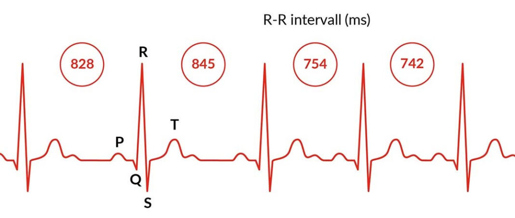 Variationen i tidsintervallet mellan hjärtslag. R-R intervall (ms)